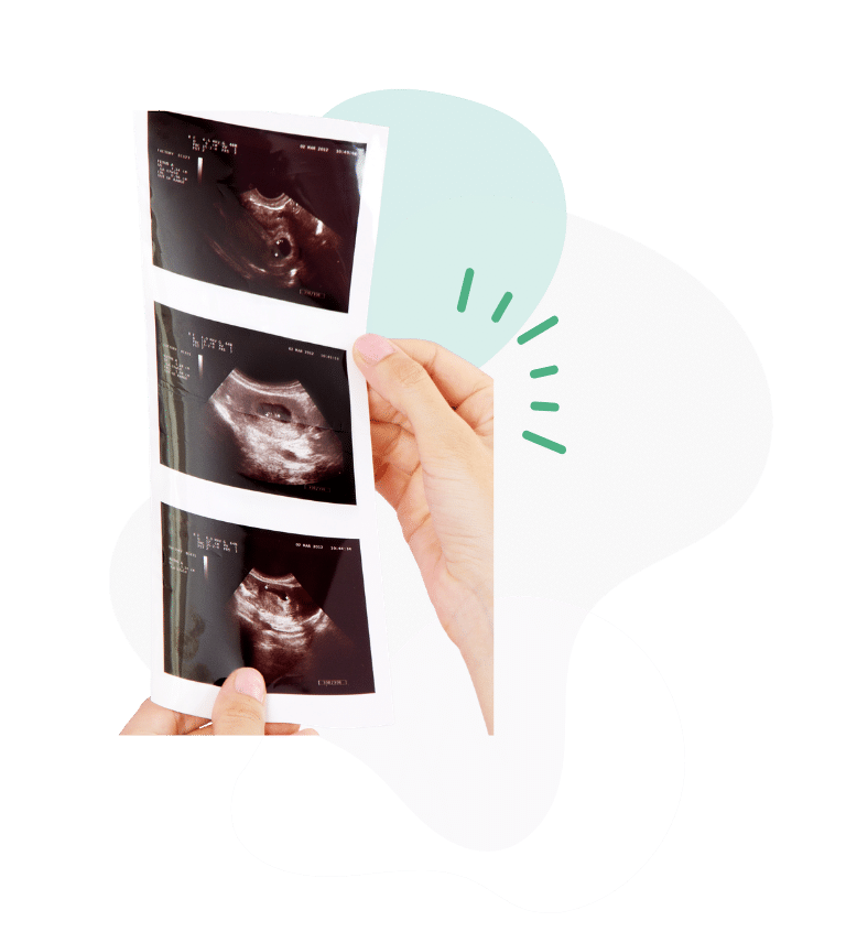 hands holding ultrasound image